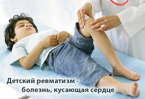 Ревматизм у детей — болезнь, которая кусает сердце